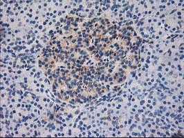 m00870 anti lipoamide dehydrogenase dld mouse monoclonal antibody clone id oti6d5 ihc testing 5