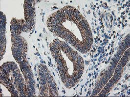 m00870 anti lipoamide dehydrogenase dld mouse monoclonal antibody clone id oti6d5 ihc testing 7