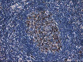 m00870 anti lipoamide dehydrogenase dld mouse monoclonal antibody clone id oti6d5 ihc testing 8