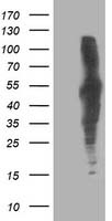 m00870 anti lipoamide dehydrogenase dld mouse monoclonal antibody clone id oti6d5 wb testing 1