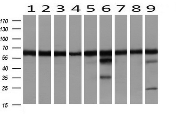m00870 anti lipoamide dehydrogenase dld mouse monoclonal antibody clone id oti6d5 wb testing 2