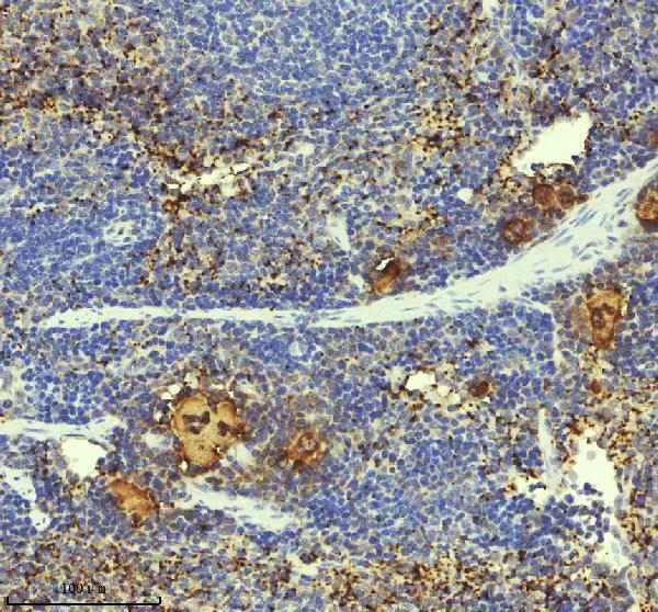 m00871 pf4 primary antibodies ihc testing 3