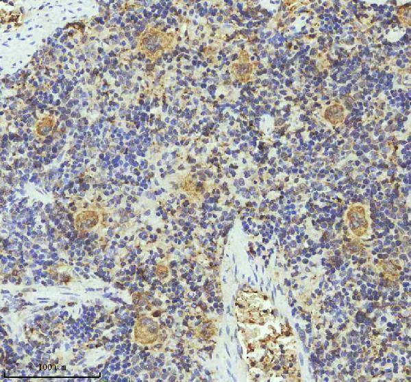 m00871 pf4 primary antibodies ihc testing 5