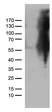 HEK293T cells were transfected with the pCMV6-ENTRY control (Left lane) or pCMV6-ENTRY IKBKG (Right lane) cDNA for 48 hrs and lysed