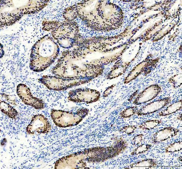  IHC analysis of CDX2 using anti-CDX2 antibody (M00877-1)