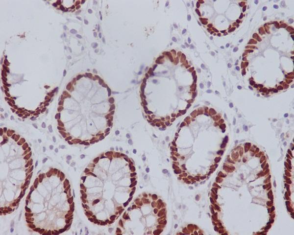 m00877 1 ihc