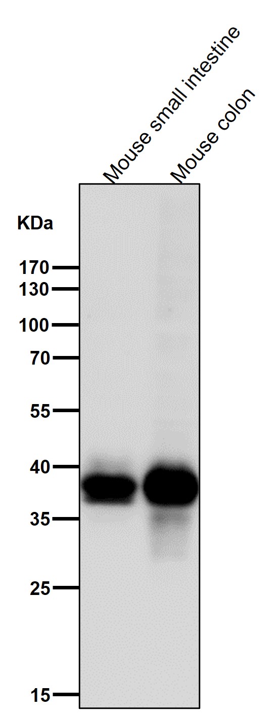 All lanes use the Antibody at 1:3K dilution for 1 hour at room temperature