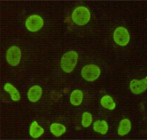 Immunocytochemistry stain of Hela using CDX2 antibody (1:100)