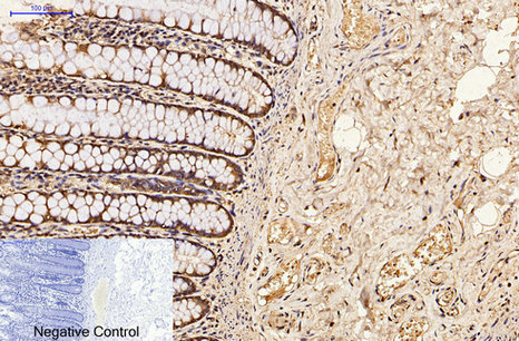 Immunohistochemical analysis of paraffin-embedded Human-colon tissue