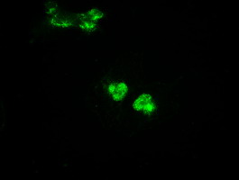 m00884 1 anti glucokinase gck mouse monoclonal antibody clone id oti3e3 if testing 11