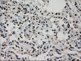 m00884 1 anti glucokinase gck mouse monoclonal antibody clone id oti3e3 ihc testing 10