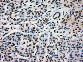 Immunohistochemical staining of paraffin-embedded Human pancreas tissue within the normal limits using anti-GCK mouse monoclonal antibody