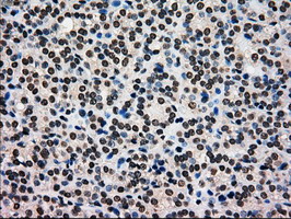 m00884 1 anti glucokinase gck mouse monoclonal antibody clone id oti3e3 ihc testing 4