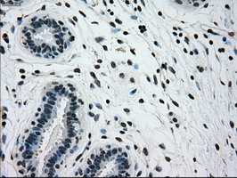 m00884 1 anti glucokinase gck mouse monoclonal antibody clone id oti3e3 ihc testing 5