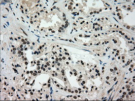 m00884 1 anti glucokinase gck mouse monoclonal antibody clone id oti3e3 ihc testing 6