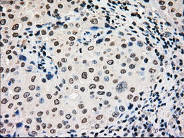 m00884 1 anti glucokinase gck mouse monoclonal antibody clone id oti3e3 ihc testing 7