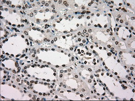 m00884 1 anti glucokinase gck mouse monoclonal antibody clone id oti3e3 ihc testing 8
