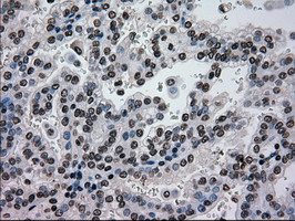 m00884 1 anti glucokinase gck mouse monoclonal antibody clone id oti3e3 ihc testing 9