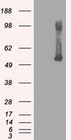 HEK293T cells were transfected with the pCMV6-ENTRY control (Left lane) or pCMV6-ENTRY GCK (Right lane) cDNA for 48 hrs and lysed