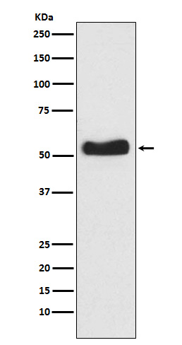 Western blot analysis of Glucokinase expression in BxPC-3 cell lysate