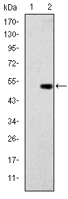 Western blotting validation for Anti-Glucokinase GCK Monoclonal Antibody M00884
Western Blot (WB) analysis using GCK Monoclonal Antibody against HEK293 (1) and GCK-hIgGFc transfected HEK293 (2) cell lysate