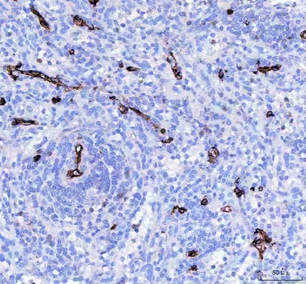  IHC analysis of CD34 using anti-CD34 antibody (M00885-1)