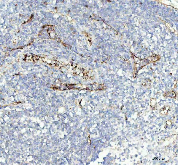  IHC analysis of CD34 using anti-CD34 antibody (M00885-1)