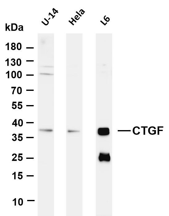 m00886 1 ctgf primary antibodies wb testing 1