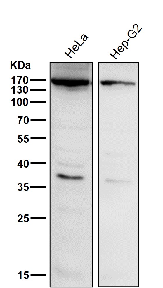 All lanes use the Antibody at 1:1K dilution for 1 hour at room temperature