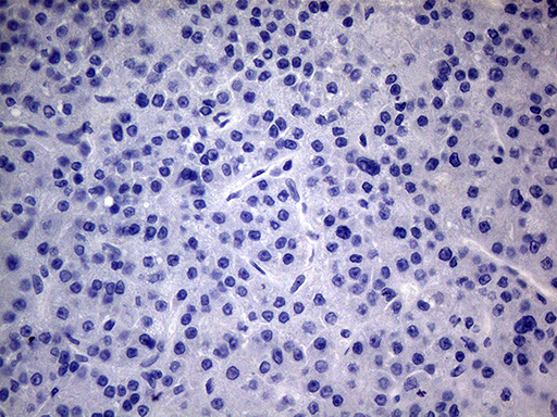 m00890 1 anti pmp22 mouse monoclonal antibody clone id oti5d1 ihc testing 3