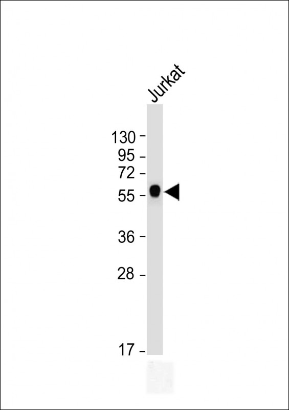 m00894 1 anti calr antibody center wb testing 2
