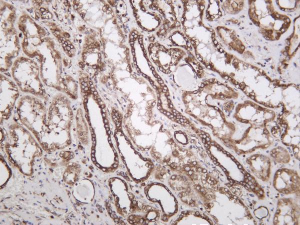 Human kidney was stained with anti-Calreticulin rabbit antibody