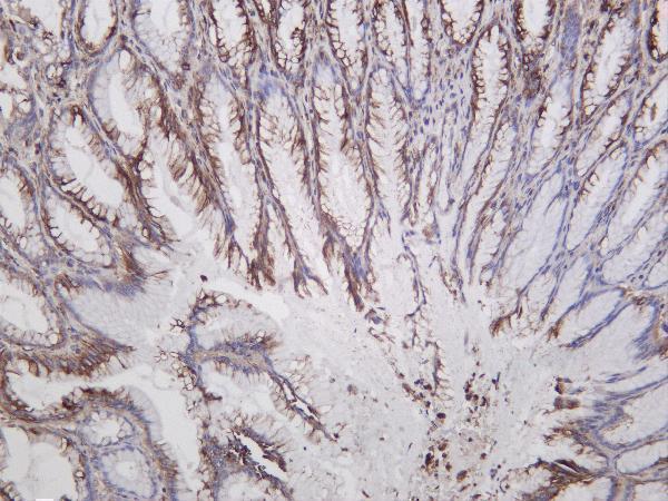 Human stomach was stained with anti-Calreticulin rabbit antibody