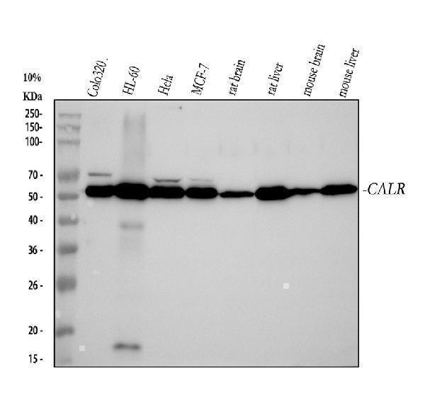 m00894 calreticulin primary antibodies wb testing 1