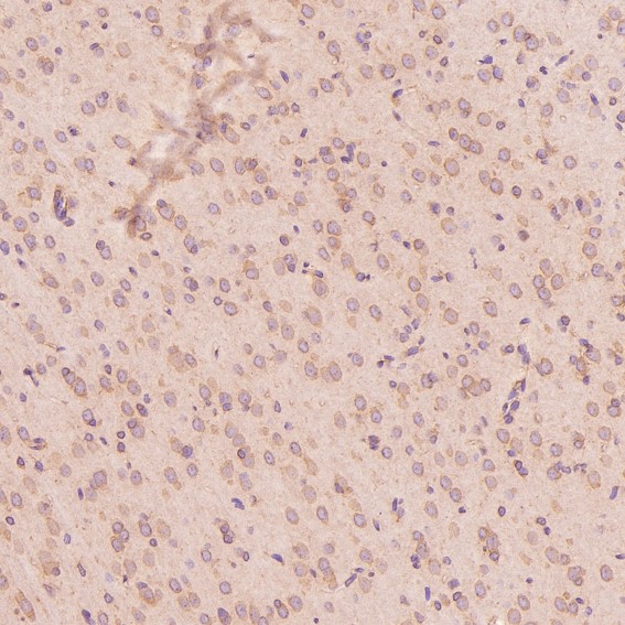 m00894 ihc7