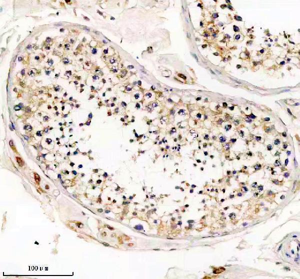 IHC analysis of GNAQ using anti-GNAQ antibody (M00898-1)
