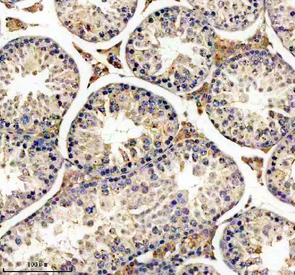 m00898 1 gnaq primary antibodies ihc testing 2