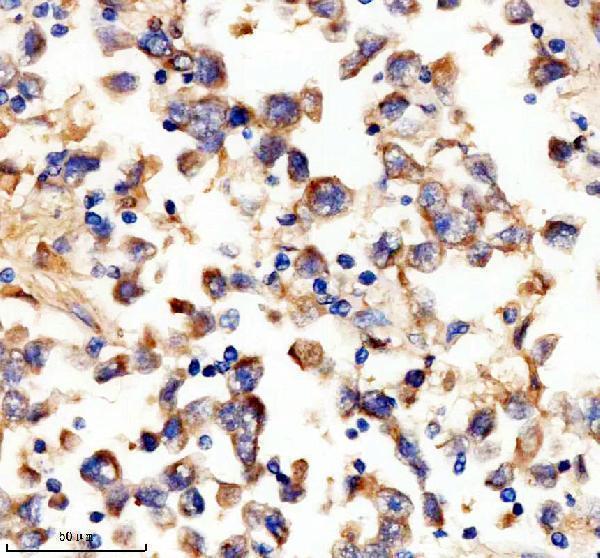 IHC analysis of UPF1 using anti-UPF1 antibody (M00900-2)