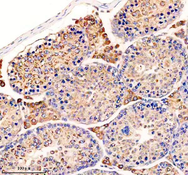 IHC analysis of UPF1 using anti-UPF1 antibody (M00900-2)