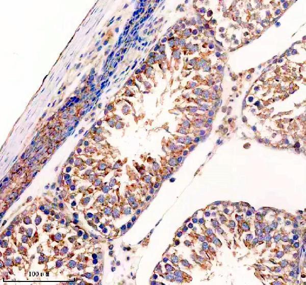 m00900 2 upf1 primary antibodies ihc testing 3