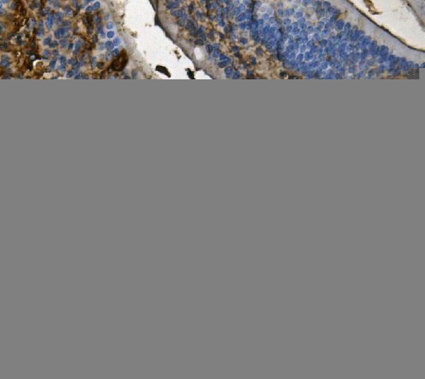 m00900 rent1 hupf1 primary antibodies ihc testing 3