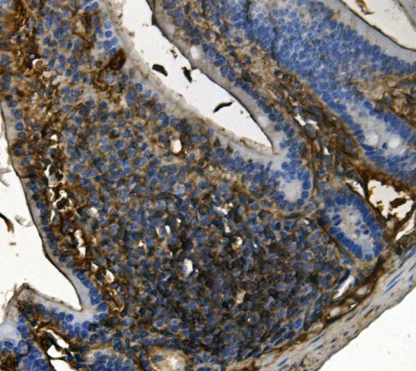 m00900 rent1 hupf1 primary antibodies ihc testing 3_1