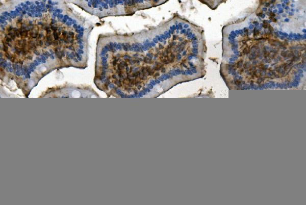 m00900 rent1 hupf1 primary antibodies ihc testing 4
