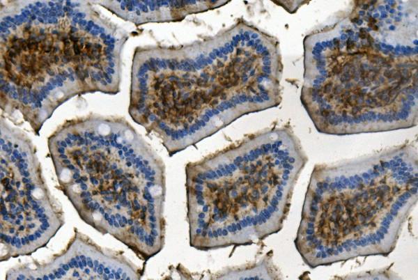 m00900 rent1 hupf1 primary antibodies ihc testing 4_1
