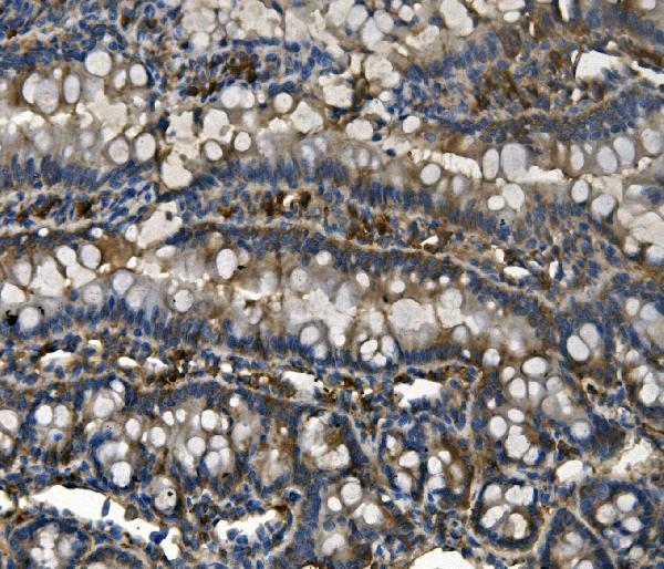 m00900 rent1 hupf1 primary antibodies ihc testing 5