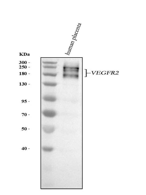  Western blot analysis of VEGFR2 using anti-VEGFR2 antibody (M00901)