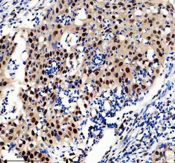 m00903 gtf2i primary antibodies ihc testing 1