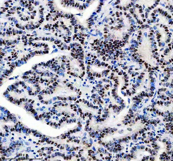 m00903 gtf2i primary antibodies ihc testing 2
