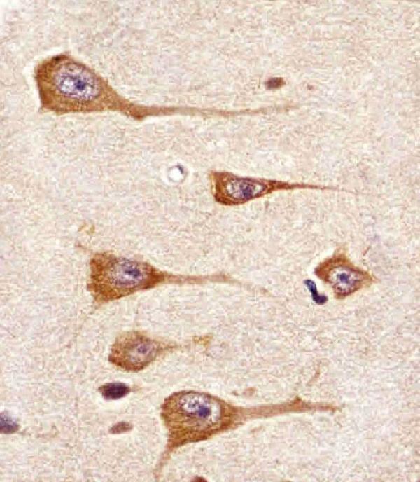 m00905 1 anti ddr1 antibody ihc p testing 2