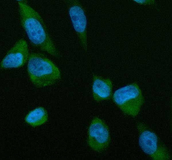 IF analysis of LCAT using anti-LCAT antibody (M00906)
